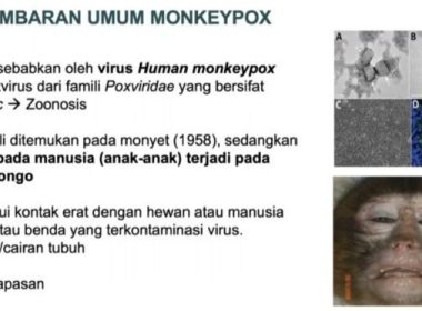 Virus cacar monyet